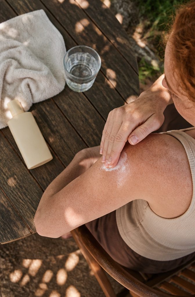 Person with freckles on sun-exposed skin